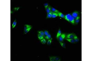 Immunofluorescence staining of Hela cells with ABIN7157894 at 1:66, counter-stained with DAPI. (Laminin gamma 1 antibody  (AA 1333-1607))
