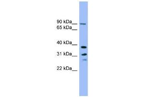 WB Suggested Anti-LHPP Antibody Titration: 0. (LHPP antibody  (Middle Region))