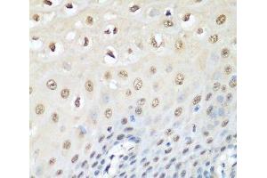 Immunohistochemistry of paraffin-embedded Human esophagus using VCP Polyclonal Antibody at dilution of 1:200 (40x lens). (VCP antibody)