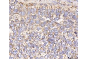IHC analysis of DLST using anti-DLST antibody (ABIN7599412). (DLST antibody  (AA 1-453))