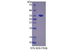 Image no. 1 for Growth Factor Receptor-Bound Protein 14 (GRB14) (AA 264-538) protein (His tag) (ABIN5665284)