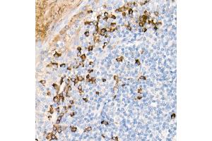 Immunohistochemistry of paraffin-embedded Human tonsil using Human IgG antibody (ABIN7267844) at dilution of 1:300 (40x lens). (IGHG1 antibody)