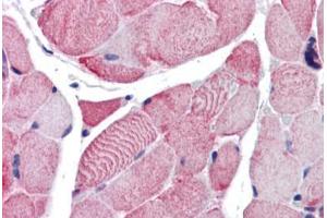 Human Skeletal Muscle (formalin-fixed, paraffin-embedded) stained with ACTB antibody ABIN337375 at 10 ug/ml followed by biotinylated goat anti-rabbit IgG secondary antibody ABIN481713, alkaline phosphatase-streptavidin and chromogen. (beta Actin antibody  (C-Term))