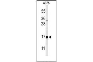 Western blot analysis of DAZAP2 Antibody (C-term) in A375 cell line lysates (35ug/lane). (DAZAP2 antibody  (C-Term))