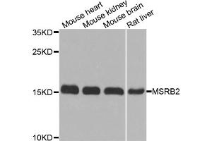 Western blot analysis of extracts of various cell lines, using MSRB2 antibody.