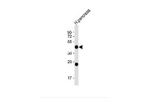 Anti-NPTX2 (C-term) at 1:1000 dilution + H. (NPTX2 antibody  (C-Term))