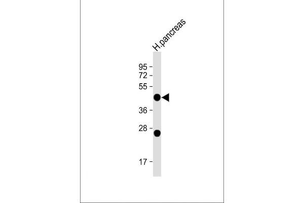 NPTX2 antibody  (C-Term)