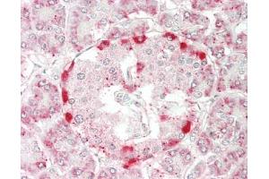 Human Pancreas: Formalin-Fixed, Paraffin-Embedded (FFPE). (RPL14 antibody  (FITC))