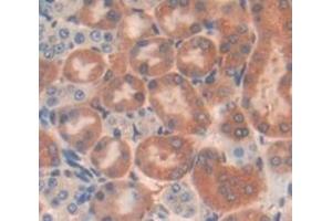 Used in DAB staining on fromalin fixed paraffin- embedded Kidney tissue (SH2B3 antibody  (AA 225-447))