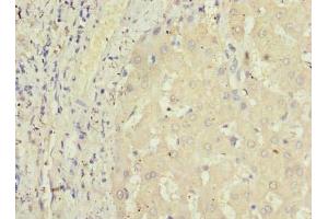 Immunohistochemistry of paraffin-embedded human liver tissue using ABIN7164457 at dilution of 1:100 (GPR146 antibody  (AA 301-333))