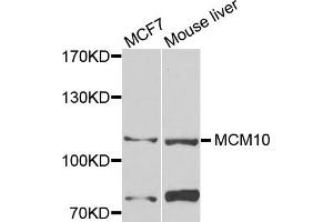 Western blot analysis of extracts of MCF7 and mouse liver cells, using MCM10 antibody.