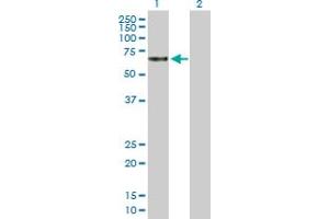Western Blot analysis of TBCD expression in transfected 293T cell line by TBCD MaxPab polyclonal antibody. (TBCD antibody  (AA 1-623))