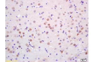 Formalin-fixed and paraffin embedded rat brain labeled with Rabbit Anti CDC10/Septin 7 Polyclonal Antibody, Unconjugated (ABIN873015) at 1:200 followed by conjugation to the secondary antibody and DAB staining (Septin 7 antibody  (AA 201-300))
