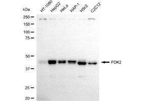Western blotting analysis using PDK2 antibody (ABIN7800083).