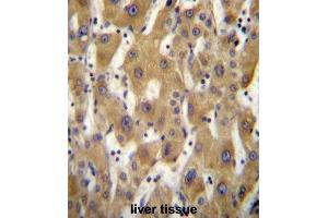 Immunohistochemistry (IHC) image for anti-P Antigen Family, Member 5 (Prostate Associated) (PAGE5) antibody (ABIN2996953)
