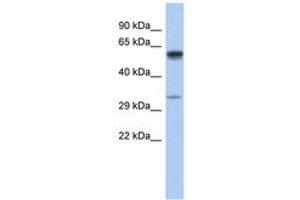 anti-Zinc Finger, DHHC-Type Containing 24 (ZDHHC24) (C-Term) antibody