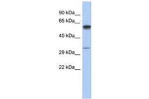 Image no. 1 for anti-Zinc Finger, DHHC-Type Containing 24 (ZDHHC24) (C-Term) antibody (ABIN6743943) (ZDHHC24 antibody  (C-Term))