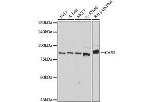 Western blot analysis of extracts of various cell lines, using CARS antibody (ABIN7266624) at 1:1000 dilution. (CARS antibody)