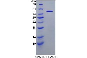 SDS-PAGE (SDS) image for Apolipoprotein A-II (APOA2) (AA 24-100) protein (His tag,GST tag) (ABIN2122419) (APOA2 Protein (AA 24-100) (His tag,GST tag))