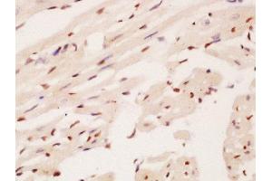 Formalin-fixed and paraffin embedded mouse heart labeled with Anti-DBPA/CSDA1 Polyclonal Antibody, Unconjugated  at 1:200 followed by conjugation to the secondary antibody and DAB staining (CSDA antibody  (AA 165-270))