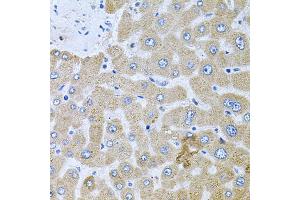 Immunohistochemistry of paraffin-embedded human liver injury using POMGNT1 antibody. (POMGNT1 antibody)