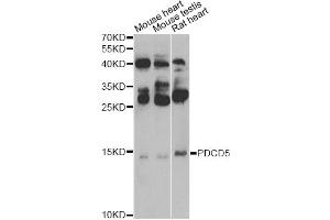 Western blot analysis of extracts of various cell lines, using PDCD5 Antibody (ABIN5974400) at 1/500 dilution.