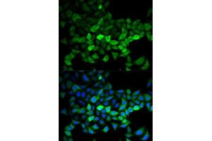 Immunofluorescence analysis of HeLa cells using UBE2C antibody. (UBE2C antibody  (AA 1-179))