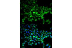 Immunofluorescence analysis of HeLa cells using UBE2C antibody. (UBE2C antibody  (AA 1-179))