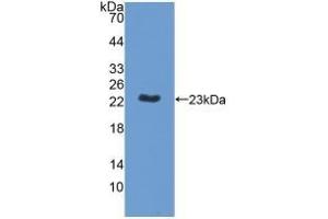 Detection of Recombinant MPP6, Human using Polyclonal Antibody to Membrane Protein, Palmitoylated 6 (MPP6) (MPP6 antibody  (AA 331-503))