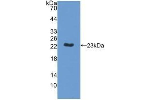 MPP6 Antikörper  (AA 331-503)