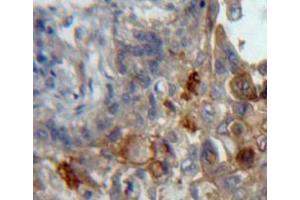 Used in DAB staining on fromalin fixed paraffin-embedded lung tissue (Podoplanin antibody  (AA 23-143))