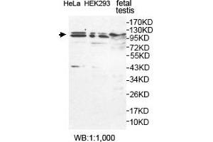 Western blot analysis of feteal testis, HeLa and HEK293 cell lysates, using USP29 antibody. (USP29 antibody  (AA 15-215))