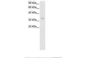 Image no. 2 for anti-Zinc Finger Protein 391 (ZNF391) (AA 66-115) antibody (ABIN6735795)