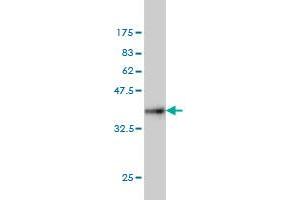 Western Blot detection against Immunogen (36. (Centrin 1 antibody  (AA 1-100))