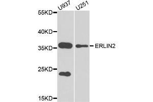 Western blot analysis of extracts of various cell lines, using ERLIN2 antibody (ABIN5974552) at 1/1000 dilution. (ERLIN2 antibody)