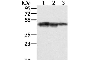 Western Blot analysis of Hepg2, K562 and Jurkat cell using SMARCB1 Polyclonal Antibody at dilution of 1:400 (SMARCB1 antibody)