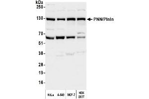 Western Blotting (WB) image for anti-Pinin, Desmosome Associated Protein (PNN) (C-Term) antibody (ABIN7451967)