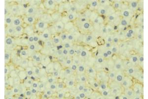 ABIN6277071 at 1/100 staining Mouse liver tissue by IHC-P.