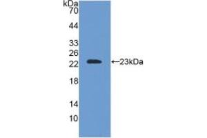 Western blot analysis of recombinant Mouse SOD2.