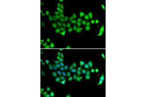 Immunofluorescence analysis of A549 cell using HSPA14 antibody.