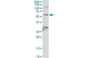 IL6R MaxPab polyclonal antibody. (IL-6 Receptor antibody  (AA 1-468))