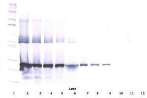 Image no. 3 for anti-WNT1 Inducible Signaling Pathway Protein 2 (WISP2) antibody (ABIN465385) (WISP2 antibody)