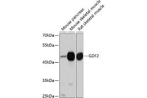 Western blot analysis of extracts of various cell lines, using GDF2 antibody (ABIN6127500, ABIN6141041, ABIN6141042 and ABIN6214818) at 1:1000 dilution. (GDF2 antibody  (AA 320-429))