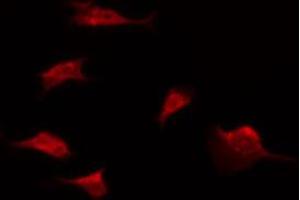 ABIN6274598 staining Hela by IF/ICC. (LI Cadherin antibody  (Internal Region))