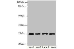 Western blot All lanes: RPS8 antibody at 6 μg/mL Lane 1: HL60 whole cell lysate Lane 2: THP-1 whole cell lysate Lane 3: 293T whole cell lysate Lane 4: Mouse liver tissue Secondary Goat polyclonal to rabbit IgG at 1/10000 dilution Predicted band size: 25 kDa Observed band size: 25 kDa