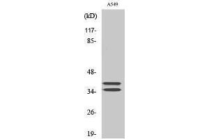 Western Blotting (WB) image for anti-Linker For Activation of T Cells (LAT) (Tyr660) antibody (ABIN3185362) (LAT antibody  (Tyr660))