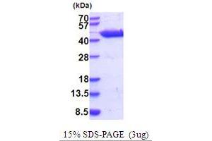 Glutamic-Oxaloacetic Transaminase 1, Soluble (Aspartate Aminotransferase 1) (GOT1) (AA 1-413) (Active) protein (His tag)
