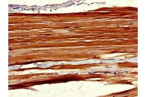 Immunohistochemistry of paraffin-embedded human skeletal muscle tissue using ABIN7158320 at dilution of 1:100 (LHFPL5 antibody  (AA 46-99))