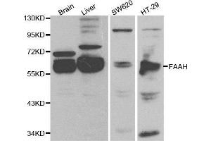 Western blot analysis of extracts of various cell lines, using FAAH antibody.