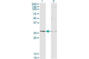 Western Blot analysis of TGIF2 expression in transfected 293T cell line by TGIF2 monoclonal antibody (M16A), clone 2D4. (TGIF2 antibody  (AA 1-237))